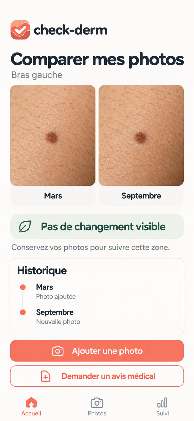 Aperçu illustratif : Historique & comparaison